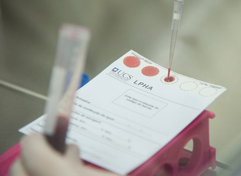 UCS participa do dezembro vermelho na prevenção e testagem de HIV