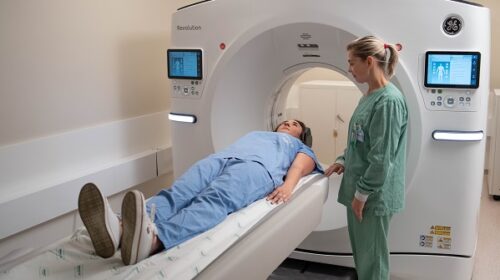 Unimed Serra Gaúcha adquire tomógrafo que utiliza inteligência artificial no diagnóstico por imagem